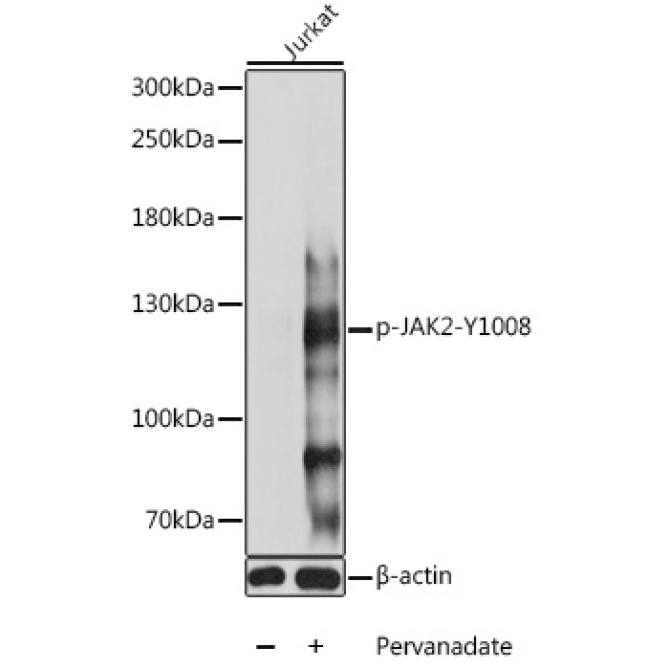Phospho-JAK2-Y1008 Rabbit Polyclonal Antibody