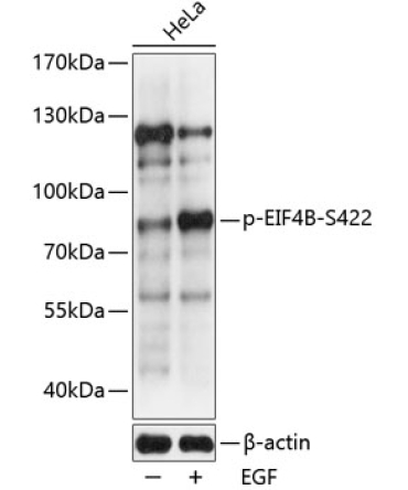 Phospho-EIF4B-S422 Rabbit Polyclonal Antibody