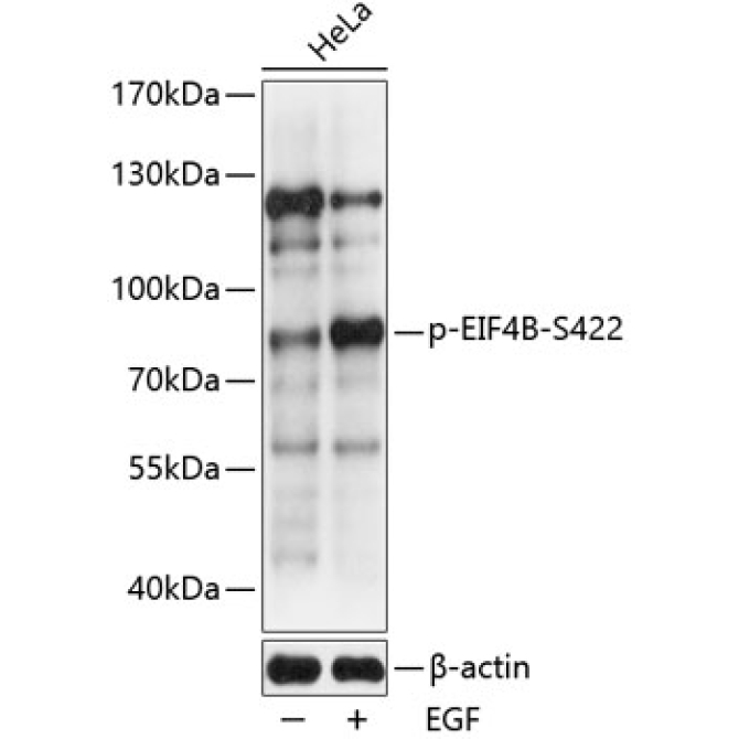 Phospho-EIF4B-S422 Rabbit Polyclonal Antibody