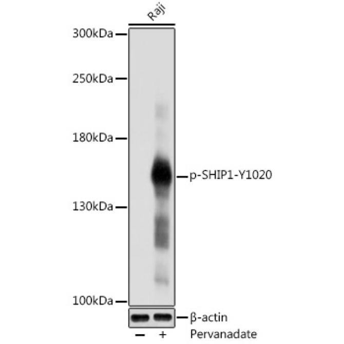 Phospho-SHIP1-Y1020 Rabbit Polyclonal Antibody