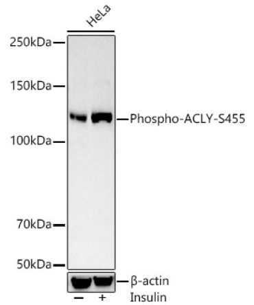 Phospho-ACLY-S455 Rabbit Polyclonal Antibody