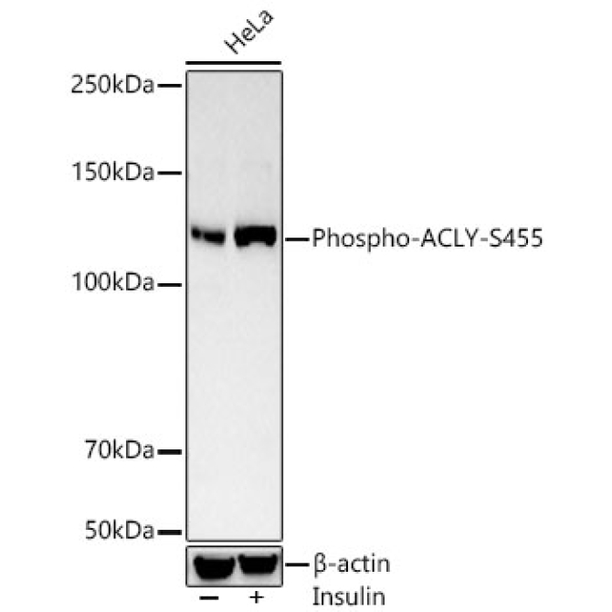 Phospho-ACLY-S455 Rabbit Polyclonal Antibody