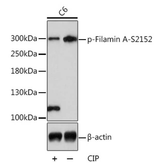 Phospho-Filamin A-S2152 Rabbit Polyclonal Antibody