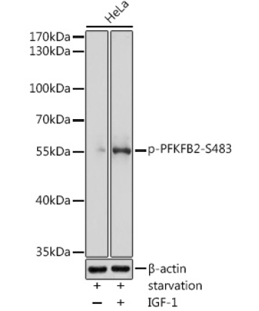 Phospho-PFKFB2-S483 Rabbit Polyclonal Antibody