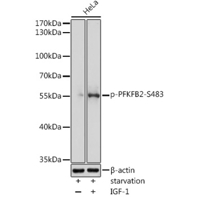 Phospho-PFKFB2-S483 Rabbit Polyclonal Antibody