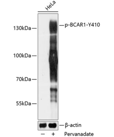 Phospho-BCAR1-Y410 Rabbit Polyclonal Antibody
