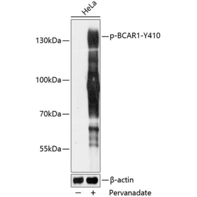 Phospho-BCAR1-Y410 Rabbit Polyclonal Antibody