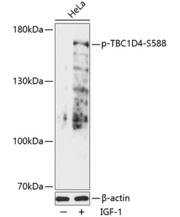 Phospho-TBC1D4-S588 Rabbit Polyclonal Antibody