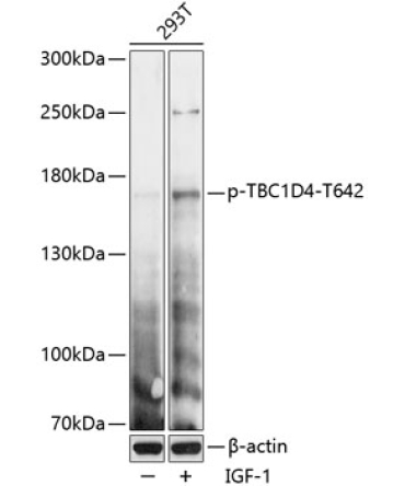 Phospho-TBC1D4-T642 Rabbit Polyclonal Antibody