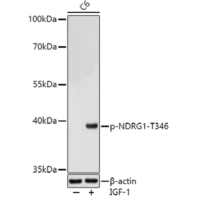Phospho-NDRG1-T346 Rabbit Polyclonal Antibody