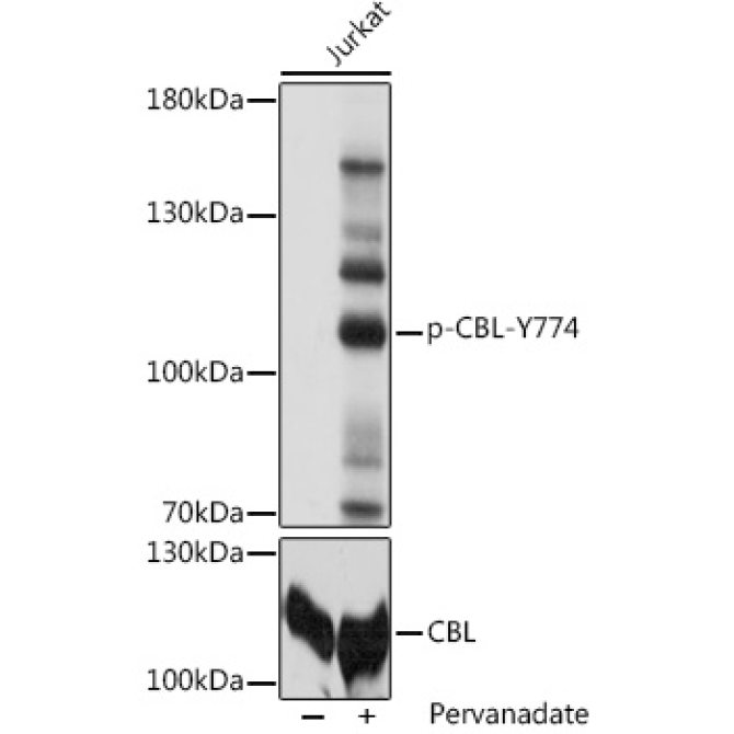 Phospho-CBL-Y774 Rabbit Polyclonal Antibody