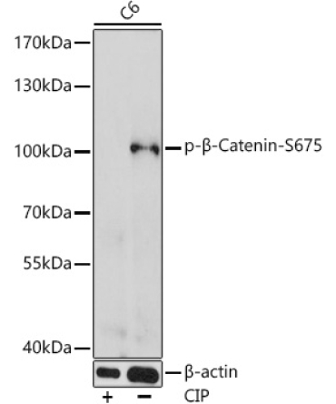 Phospho-Beta-Catenin-S675 Rabbit Polyclonal Antibody
