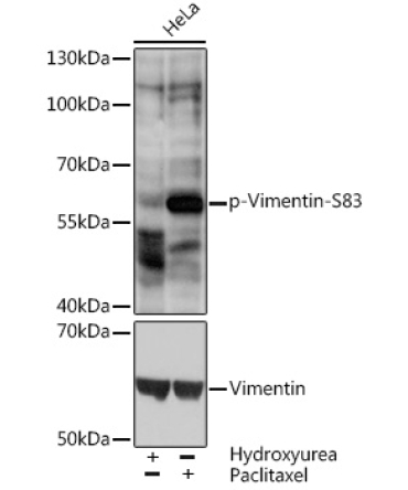 Phospho-Vimentin-S83 Rabbit Polyclonal Antibody