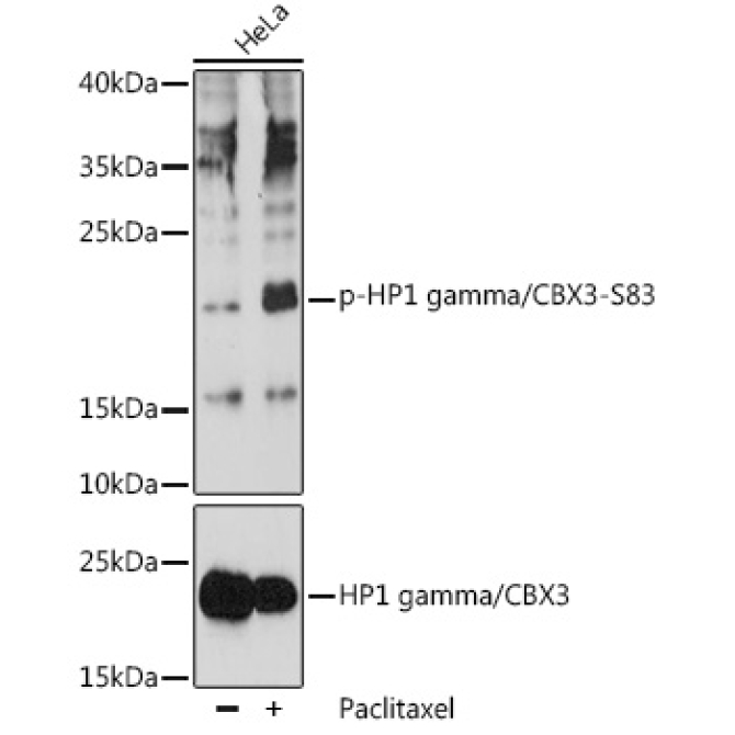 Phospho-HP1 gamma/CBX3-S83 Rabbit Polyclonal Antibody