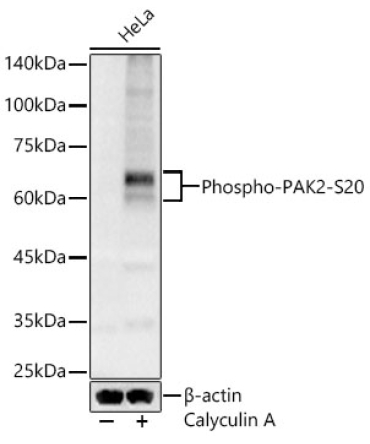 Phospho-PAK2-S20 Rabbit Polyclonal Antibody