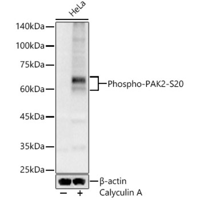 Phospho-PAK2-S20 Rabbit Polyclonal Antibody