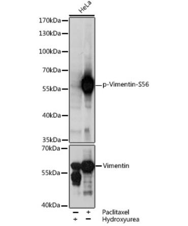 Phospho-Vimentin-S56 Rabbit Polyclonal Antibody