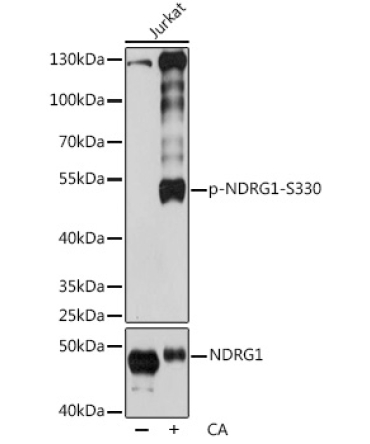 Phospho-NDRG1-S330 Rabbit Polyclonal Antibody