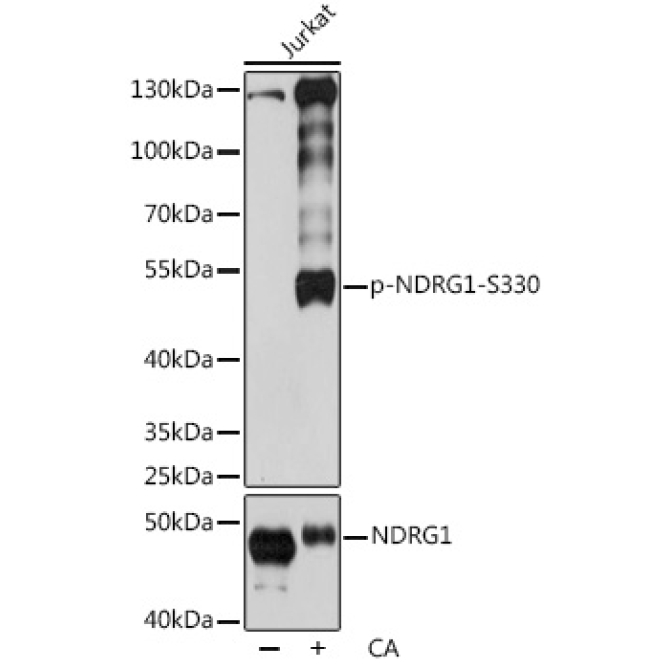 Phospho-NDRG1-S330 Rabbit Polyclonal Antibody