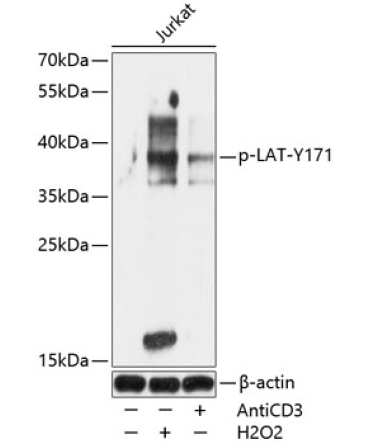 Phospho-LAT-Y171 Rabbit Polyclonal Antibody