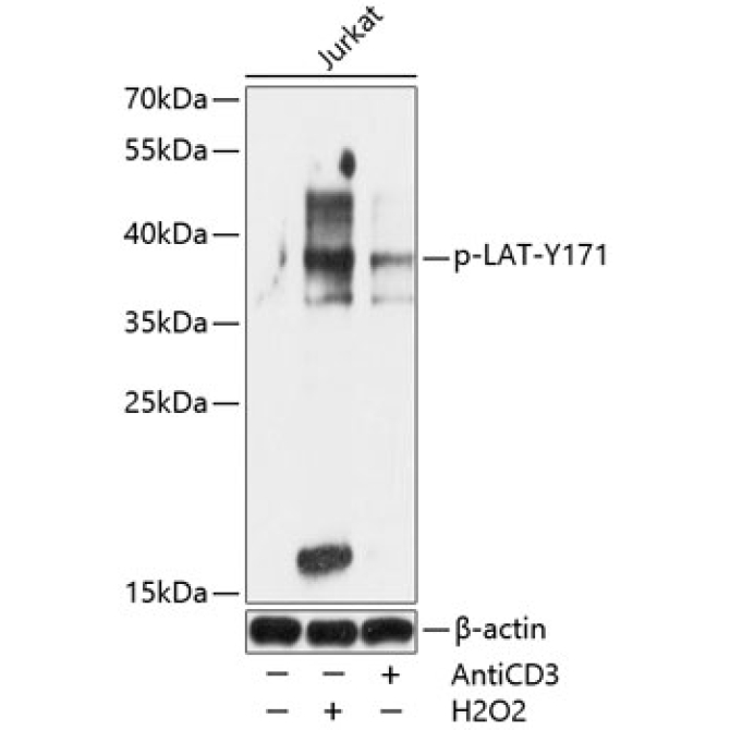 Phospho-LAT-Y171 Rabbit Polyclonal Antibody
