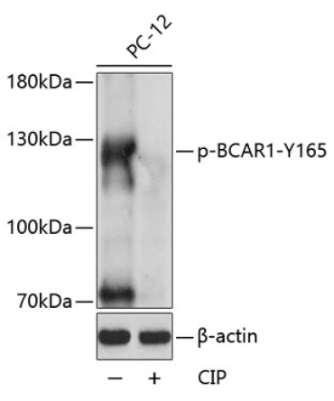 Phospho-BCAR1-Y165 Rabbit Polyclonal Antibody