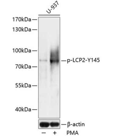 Phospho-LCP2-Y145 Rabbit Polyclonal Antibody