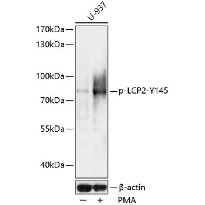Phospho-LCP2-Y145 Rabbit Polyclonal Antibody