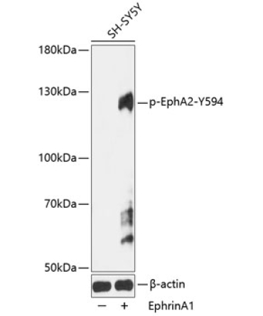 Phospho-EPHA2-Y594 Rabbit Polyclonal Antibody
