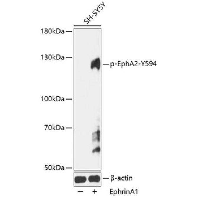 Phospho-EPHA2-Y594 Rabbit Polyclonal Antibody