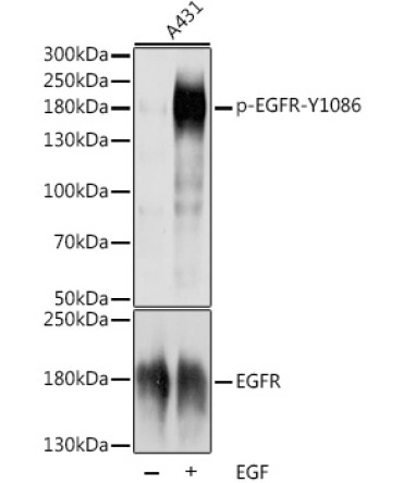 Phospho-EGFR-Y19,4006 Rabbit Polyclonal Antibody