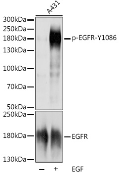 Phospho-EGFR-Y19,4006 Rabbit Polyclonal Antibody