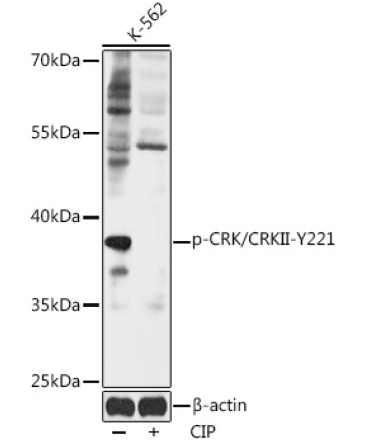 Phospho-CRK/CRKII-Y221 Rabbit Polyclonal Antibody