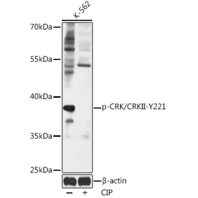 Phospho-CRK/CRKII-Y221 Rabbit Polyclonal Antibody