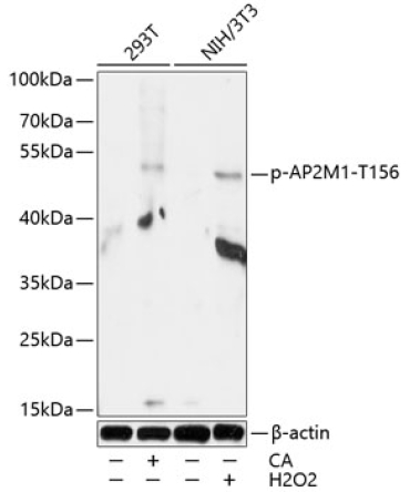 Phospho-AP2M1-T156 Rabbit Polyclonal Antibody