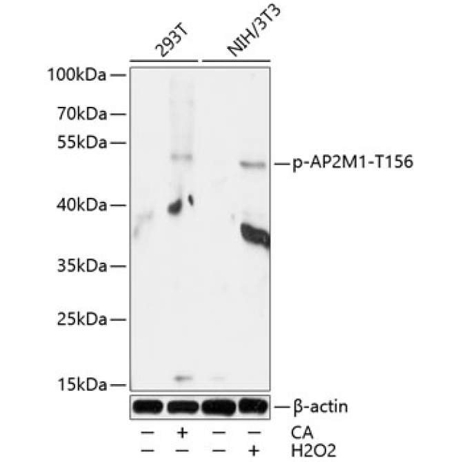 Phospho-AP2M1-T156 Rabbit Polyclonal Antibody