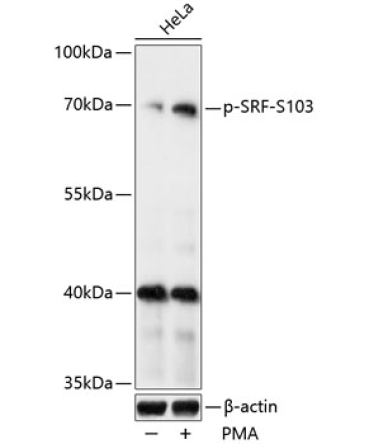 Phospho-SRF-S103 Rabbit Polyclonal Antibody