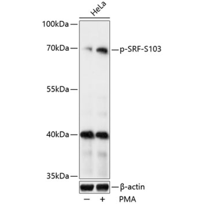 Phospho-SRF-S103 Rabbit Polyclonal Antibody