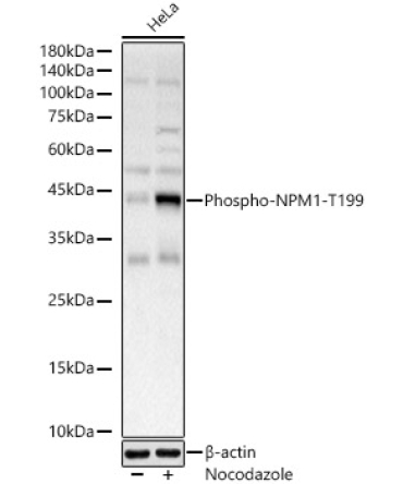 Phospho-NPM1-T199 Rabbit Polyclonal Antibody