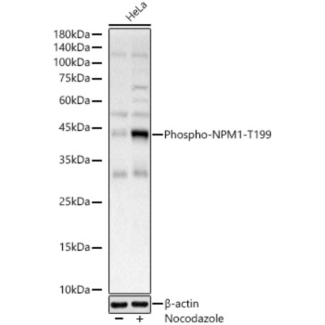 Phospho-NPM1-T199 Rabbit Polyclonal Antibody