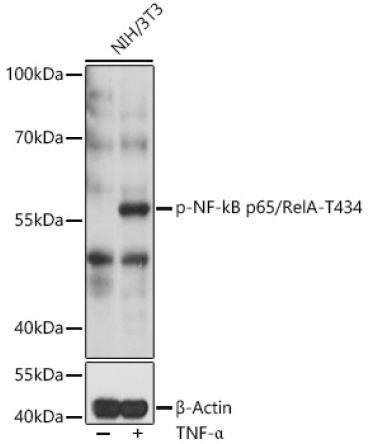 Phospho-NF-kB p65/RelA-T435 Rabbit Polyclonal Antibody