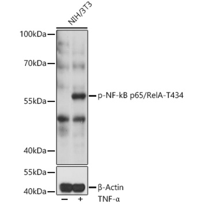 Phospho-NF-kB p65/RelA-T435 Rabbit Polyclonal Antibody