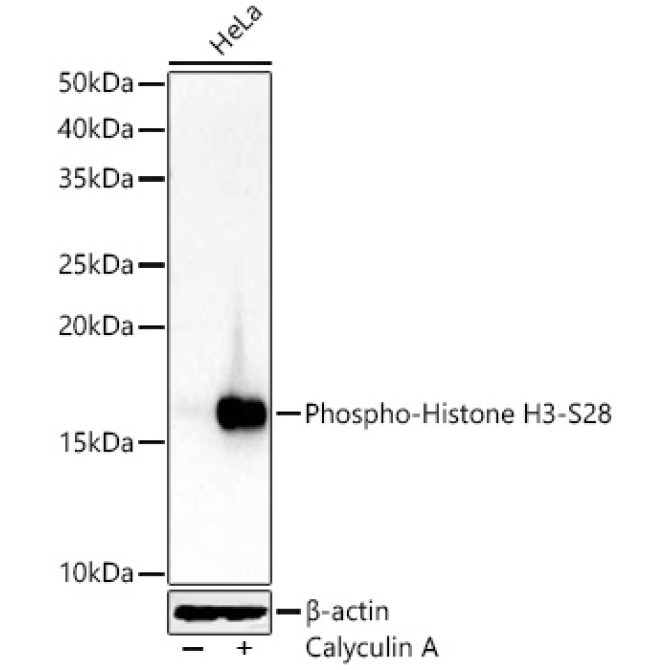 Phospho-Histone H3-S28 Rabbit Polyclonal Antibody