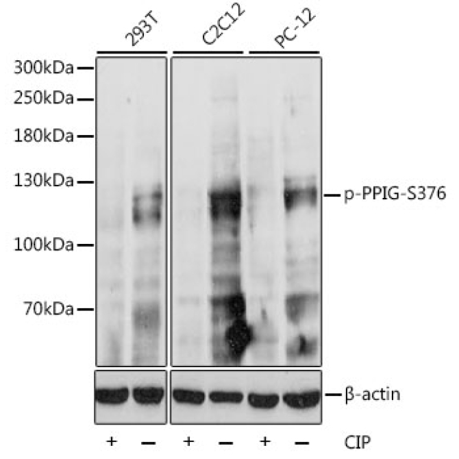 Phospho-PPIG-S376 Rabbit Polyclonal Antibody