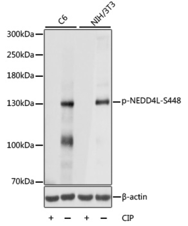 Phospho-NEDD4L-S448 Rabbit Polyclonal Antibody