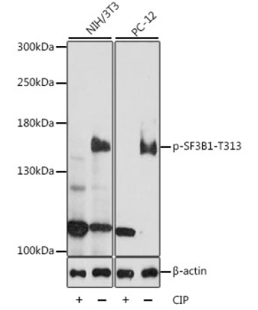 Phospho-SF3B1-T313 Rabbit Polyclonal Antibody