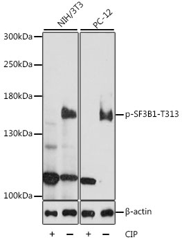 Phospho-SF3B1-T313 Rabbit Polyclonal Antibody