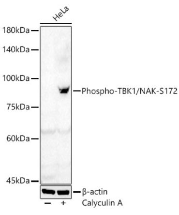 Phospho-TBK1/NAK-S172 Rabbit Polyclonal Antibody