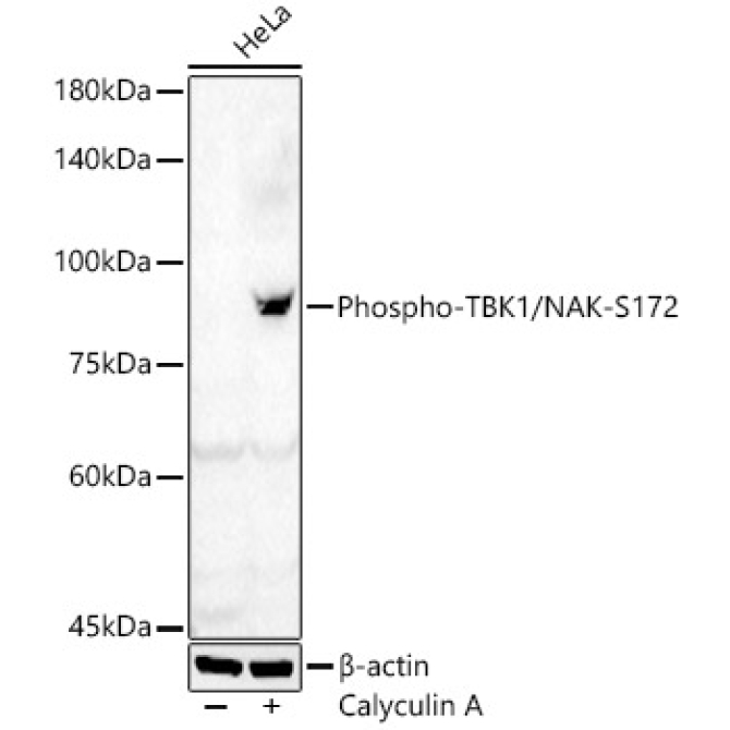 Phospho-TBK1/NAK-S172 Rabbit Polyclonal Antibody