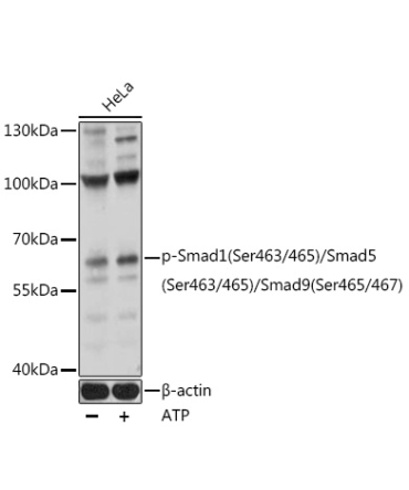 Phospho-Smad1-S463/465 + Smad5-S463/465 + Smad9-S465/467 Rabbit Polyclonal Antibody